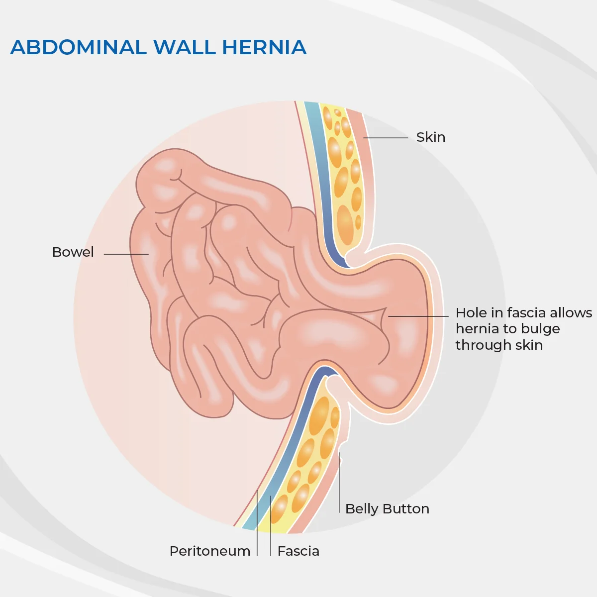 Belly Button Anatomy Diagram Belly Button Anatomy Diagram